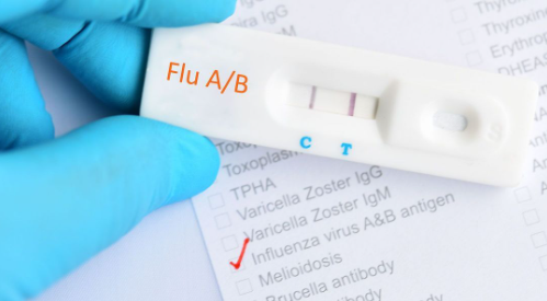 Bối cảnh và điều trị xét nghiệm chẩn đoán nhanh cúm