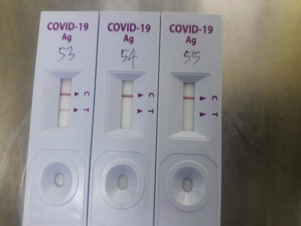 Kiểm tra kháng nguyên PCR vs: Thử nghiệm covid-19 nào phù hợp với tôi?